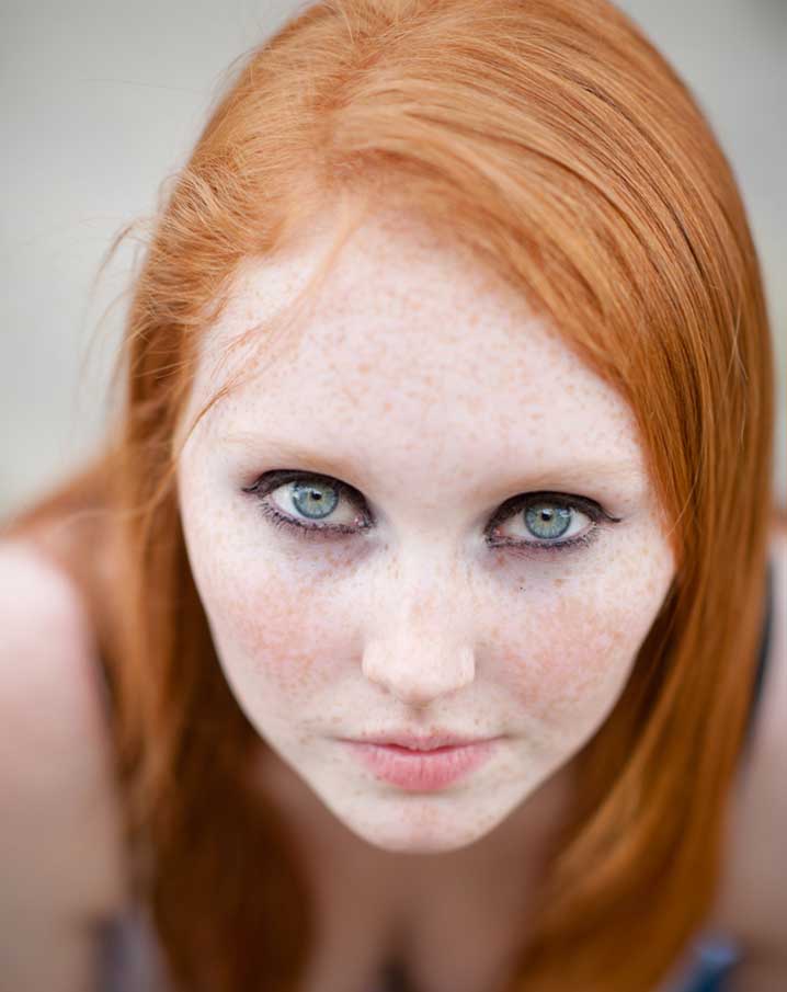 Photography Girls with Freckles are Cute and Beautiful pic image